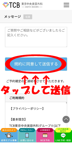 TCB東京中央美容外科予約フォーム